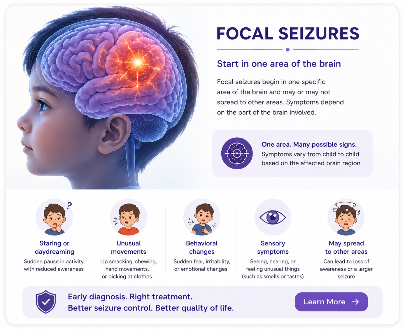 Focal Seizure Dr Sunil Sable Pediatric Neurologist and Epilepsy Specialist Ahilynagar(Ahmednagar) Maharashtra