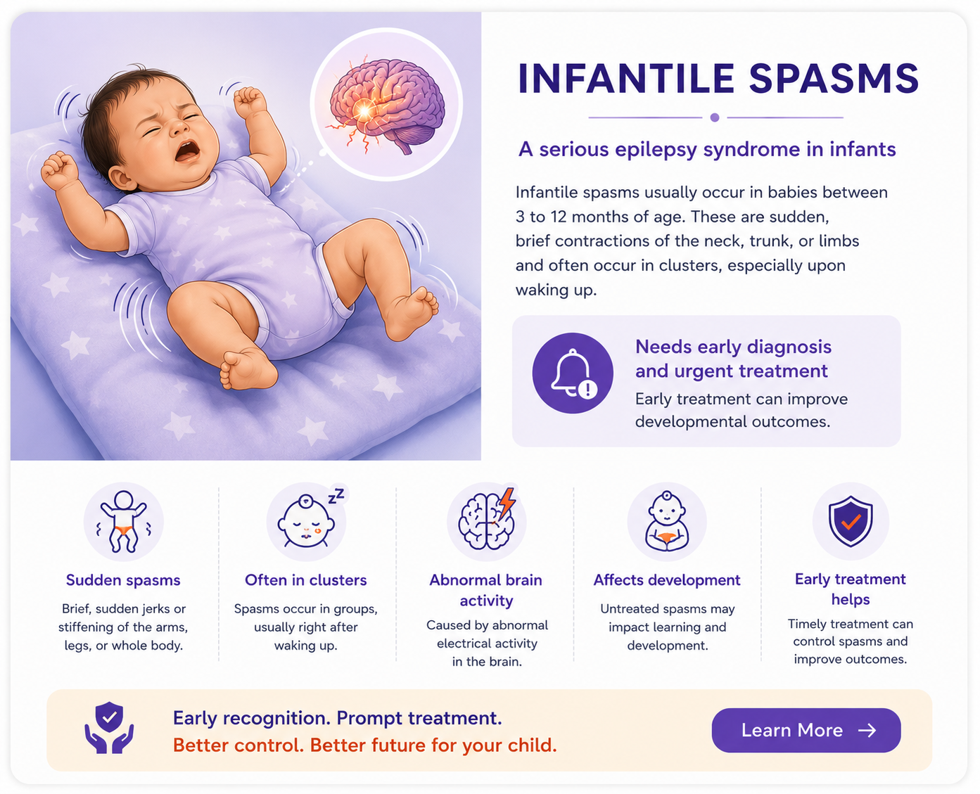 Infantile Spasm Dr Sunil Sable Pediatric Neurologist and Epilepsy Specialist Ahilynagar(Ahmednagar) Maharashtra